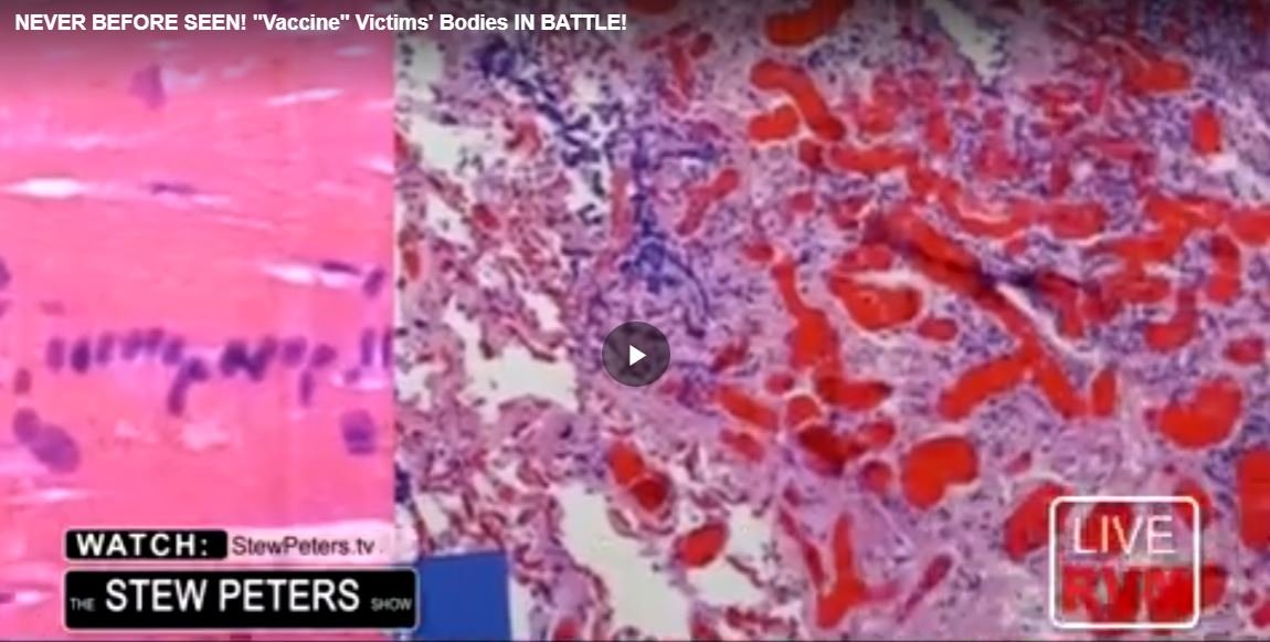 NEVER BEFORE SEEN! “Vaccine” Victims’ Bodies IN BATTLE!