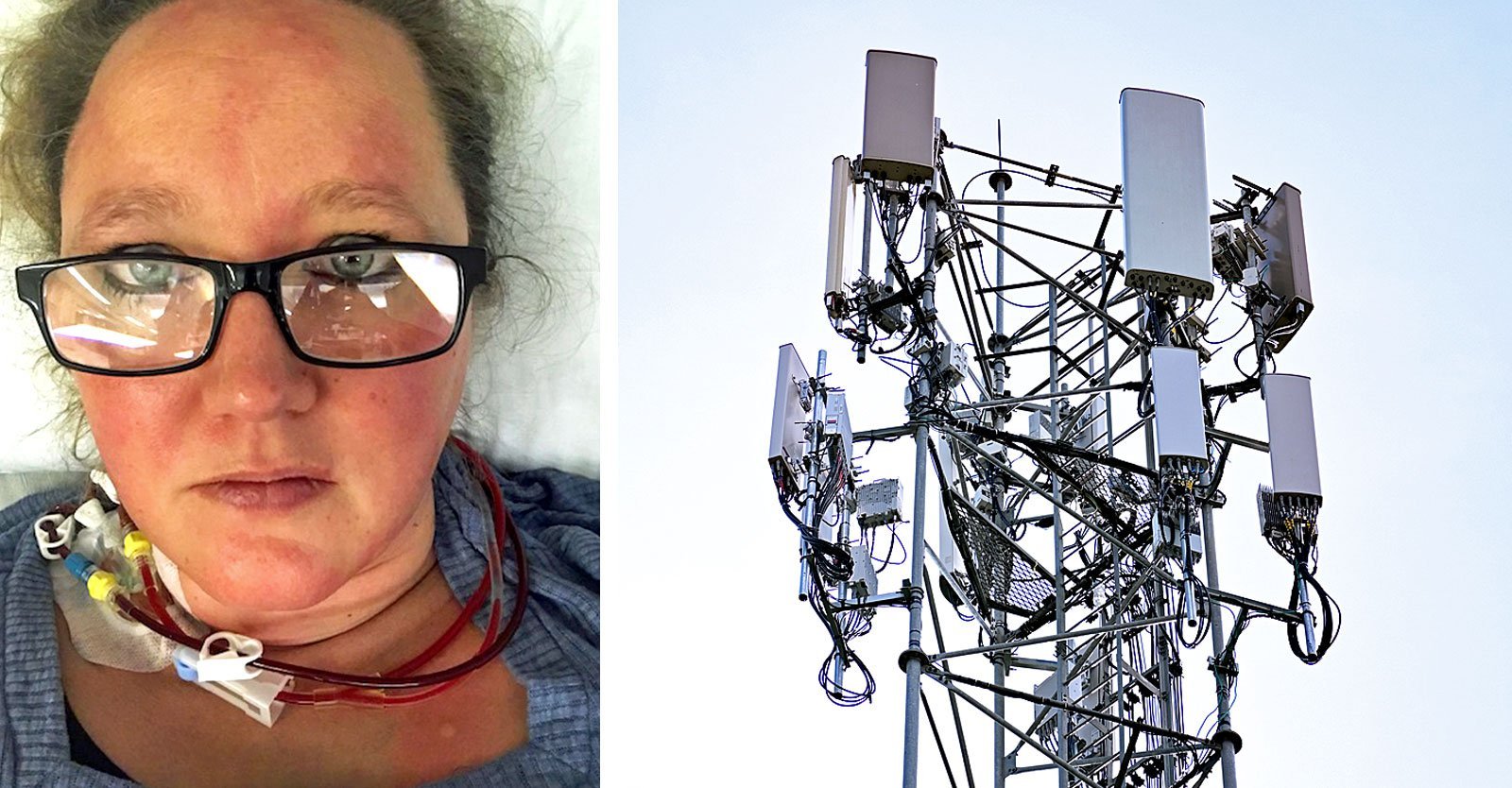 Woman Living Near Cell Tower Diagnosed With 51 Strokes
