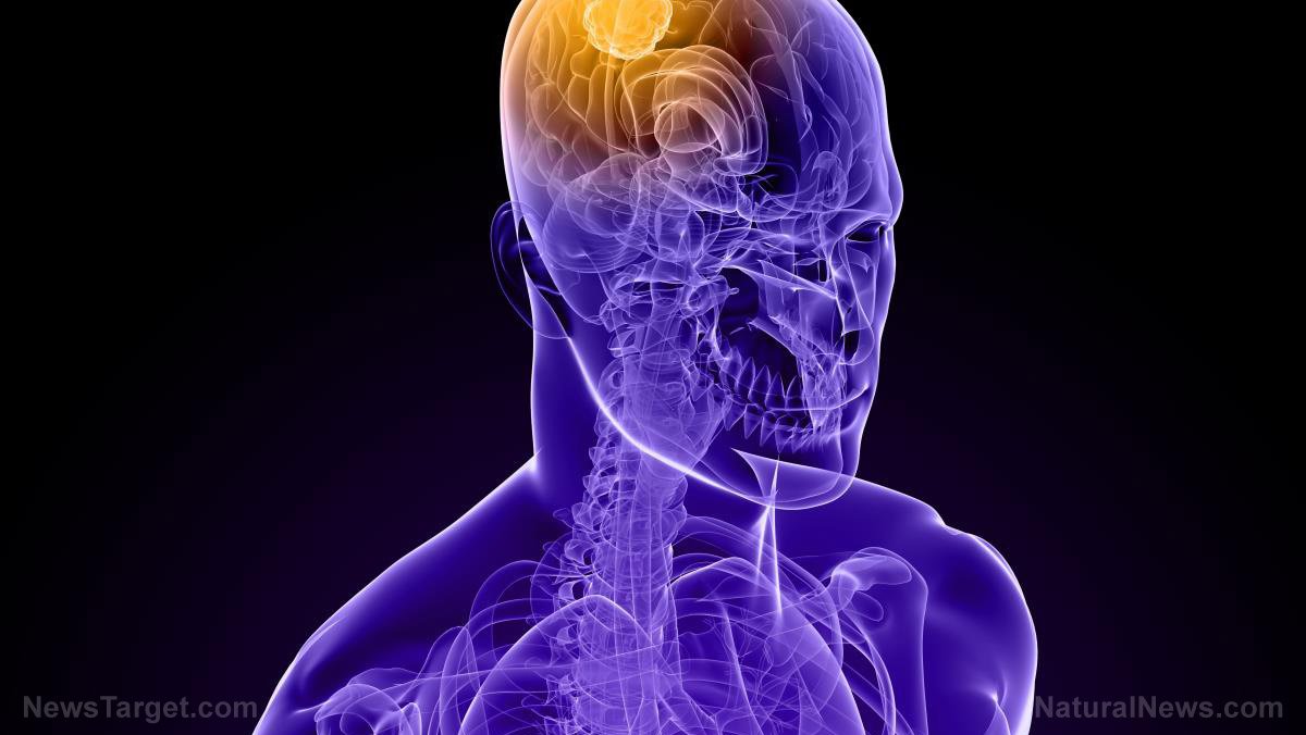 60 Minutes now claims Directed Energy Weapons (DEW) are real, not conspiracy, because Russia is supposedly using them against us